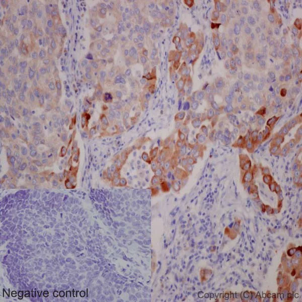 Immunohistochemistry (Formalin/PFA-fixed paraffin-embedded sections) - Anti-ROS1 antibody [EPMGHR2] - BSA and Azide free (AB238986)