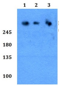 Western blot - Anti-ROS1 (phospho Y2114) antibody (AB191522)
