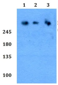 Western blot - Anti-ROS1 (phospho Y2114) antibody (AB191522)