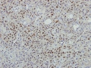 Immunohistochemistry (Formalin/PFA-fixed paraffin-embedded sections) - Anti-ROX antibody (AB155335)