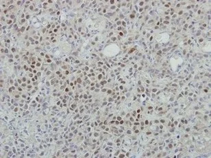Immunohistochemistry (Formalin/PFA-fixed paraffin-embedded sections) - Anti-ROX antibody (AB155335)