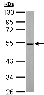 Western blot - Anti-ROX antibody (AB155335)