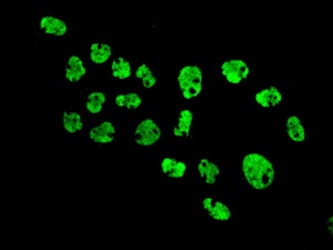Immunocytochemistry/ Immunofluorescence - Anti-ROX antibody [EPR11721] (AB173573)