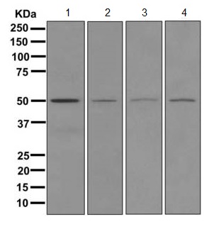 Western blot - Anti-ROX antibody [EPR11721] (AB173573)