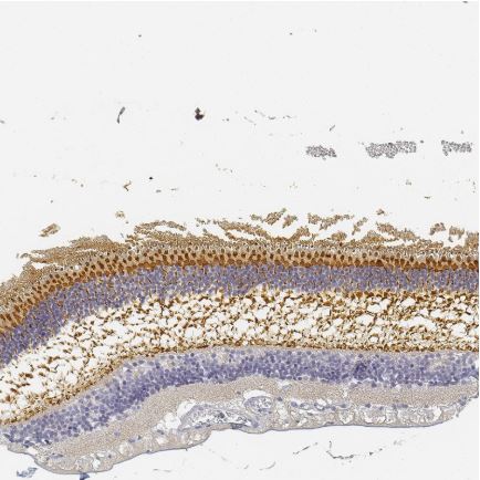 Immunohistochemistry (Formalin/PFA-fixed paraffin-embedded sections) - Anti-RP1 antibody (AB122781), expandable thumbnail