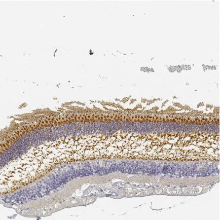 Immunohistochemistry (Formalin/PFA-fixed paraffin-embedded sections) - Anti-RP1 antibody (AB122781)