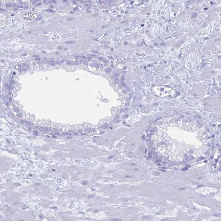 Immunohistochemistry (Formalin/PFA-fixed paraffin-embedded sections) - Anti-RP1 antibody (AB122781)