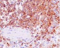 Immunohistochemistry (Formalin/PFA-fixed paraffin-embedded sections) - Anti-RP105 antibody [EPR14720] (AB184956), expandable thumbnail