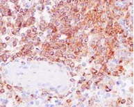Immunohistochemistry (Formalin/PFA-fixed paraffin-embedded sections) - Anti-RP105 antibody [EPR14720] (AB184956)