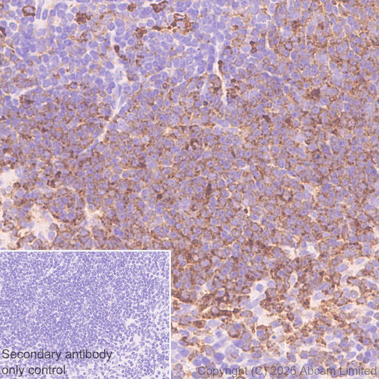 Immunohistochemistry (Formalin/PFA-fixed paraffin-embedded sections) - Anti-RP105 antibody [EPR14720] (AB184956)