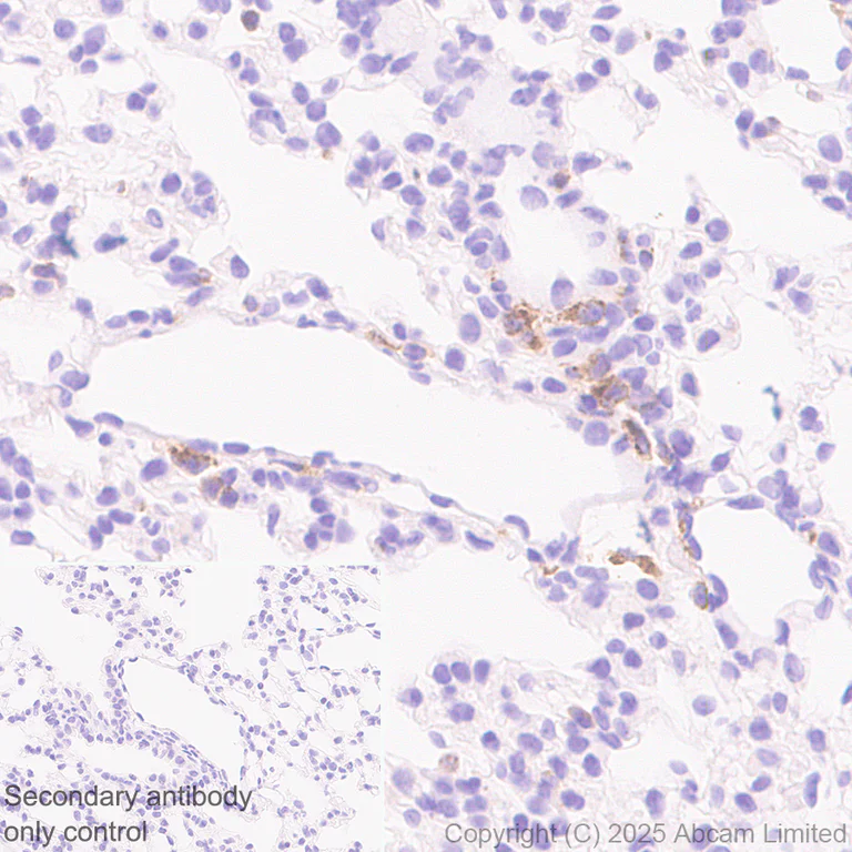 Immunohistochemistry (Formalin/PFA-fixed paraffin-embedded sections) - Anti-RP105 antibody [EPR14720] (AB184956)