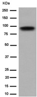 Western blot - Anti-RP105 antibody [EPR14720] (AB184956), expandable thumbnail