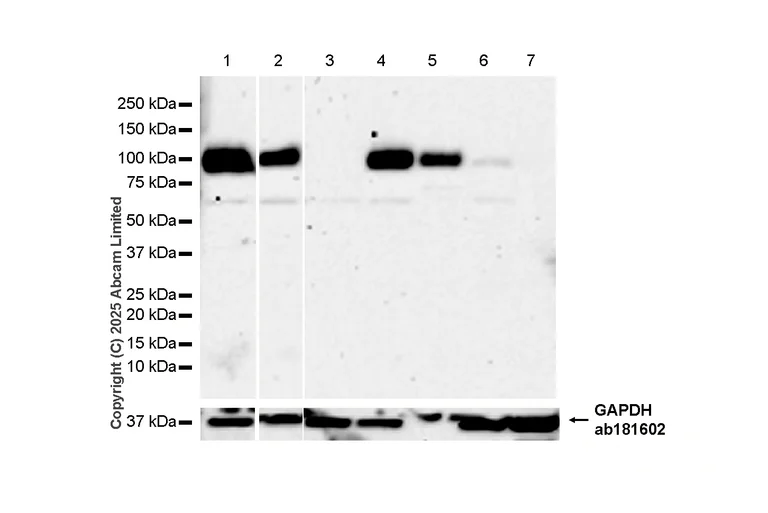 Western blot - Anti-RP105 antibody [EPR14720] - BSA and Azide free (AB250792)