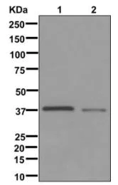 Western blot - Anti-RP2 antibody [EPR11362] (AB174840)