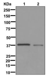 Western blot - Anti-RP2 antibody [EPR11362] - BSA and Azide free (AB249828), expandable thumbnail