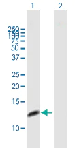 Western blot - Anti-RPA14/RPA3 antibody (AB167593)