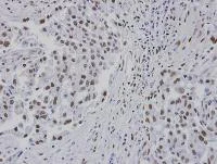 Immunohistochemistry (Formalin/PFA-fixed paraffin-embedded sections) - Anti-RPA14/RPA3 antibody (AB97436)