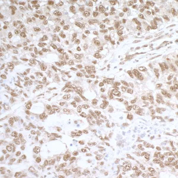 Immunohistochemistry (Formalin/PFA-fixed paraffin-embedded sections) - Anti-Rpa2 (phospho S4 + S8) antibody (AB264116)