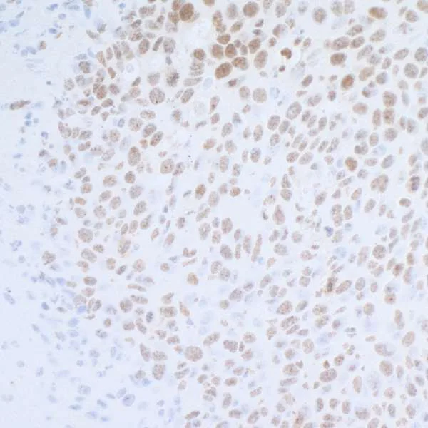 Immunohistochemistry (Formalin/PFA-fixed paraffin-embedded sections) - Anti-Rpa2 (phospho S4 + S8) antibody (AB264116)