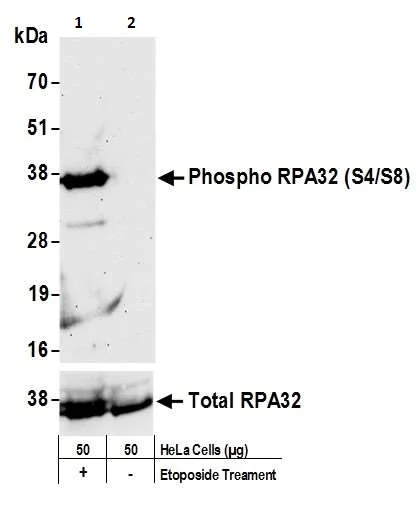 Western blot - Anti-Rpa2 (phospho S4 + S8) antibody (AB264116)