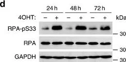 Western blot - Anti-RPA32/RPA2 antibody [9H8] (AB2175)