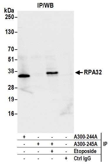 Immunoprecipitation - Anti-RPA32/RPA2 antibody (AB10359), expandable thumbnail
