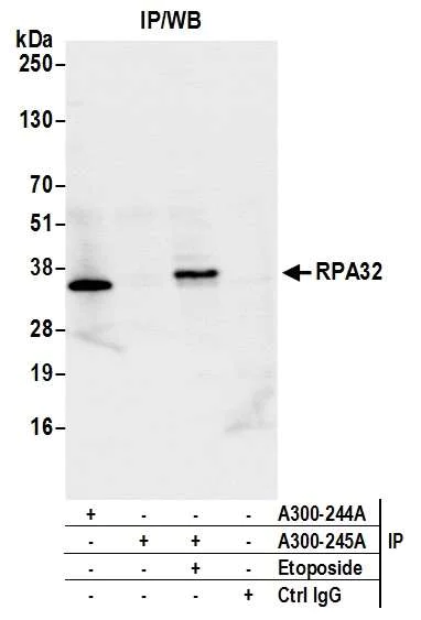 Immunoprecipitation - Anti-RPA32/RPA2 antibody (AB10359)