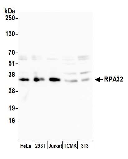 Western blot - Anti-RPA32/RPA2 antibody (AB10359), expandable thumbnail