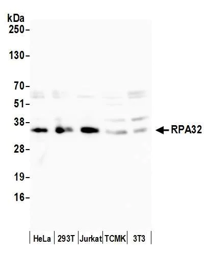 Western blot - Anti-RPA32/RPA2 antibody (AB10359)
