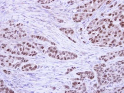 Immunohistochemistry (Formalin/PFA-fixed paraffin-embedded sections) - Anti-RPA32/RPA2 antibody (AB97594)