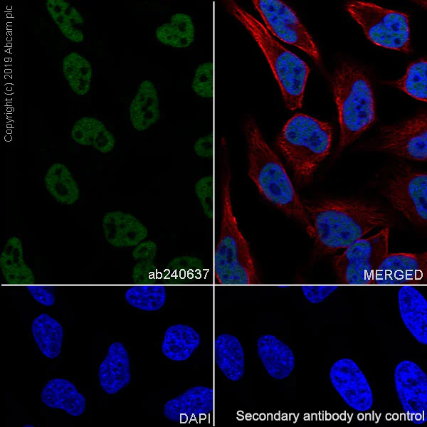 Immunocytochemistry/ Immunofluorescence - Anti-RPA32/RPA2 antibody [EPR22950-81] (AB240637)
