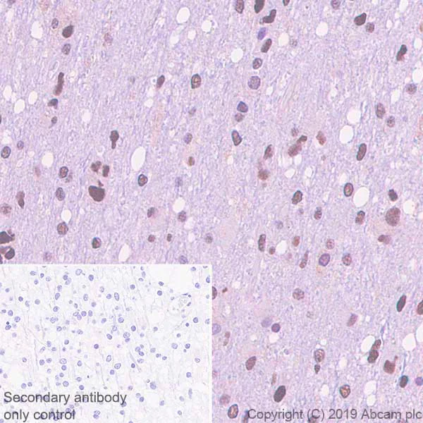 Immunohistochemistry (Formalin/PFA-fixed paraffin-embedded sections) - Anti-RPA32/RPA2 antibody [EPR22950-81] (AB240637)
