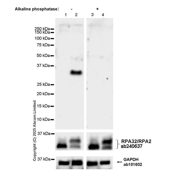 Western blot - Anti-RPA32/RPA2 antibody [EPR22950-81] (AB240637)