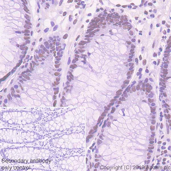Immunohistochemistry (Formalin/PFA-fixed paraffin-embedded sections) - Anti-RPA32/RPA2 antibody [EPR22950-81] - BSA and Azide free (AB256819)