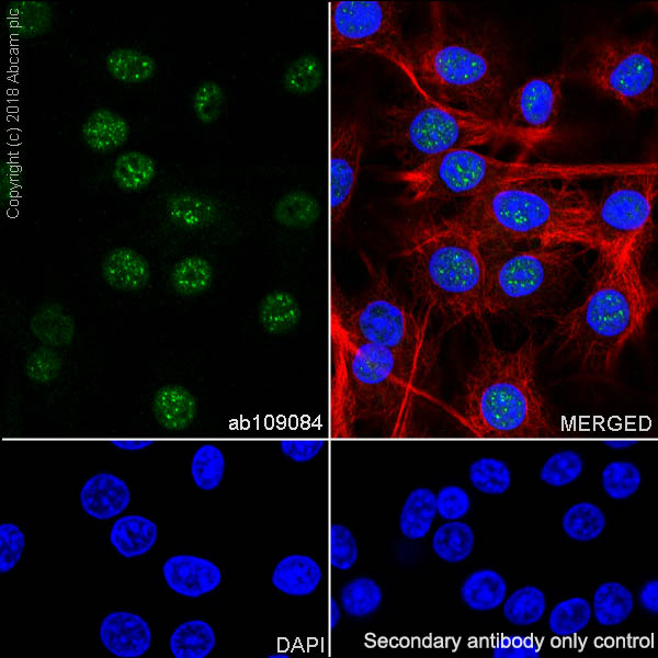 Immunocytochemistry/ Immunofluorescence - Anti-RPA32/RPA2 antibody [EPR2876(2)] (AB109084), expandable thumbnail