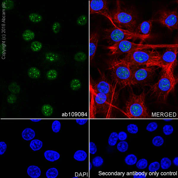 Immunocytochemistry/ Immunofluorescence - Anti-RPA32/RPA2 antibody [EPR2876(2)] (AB109084)