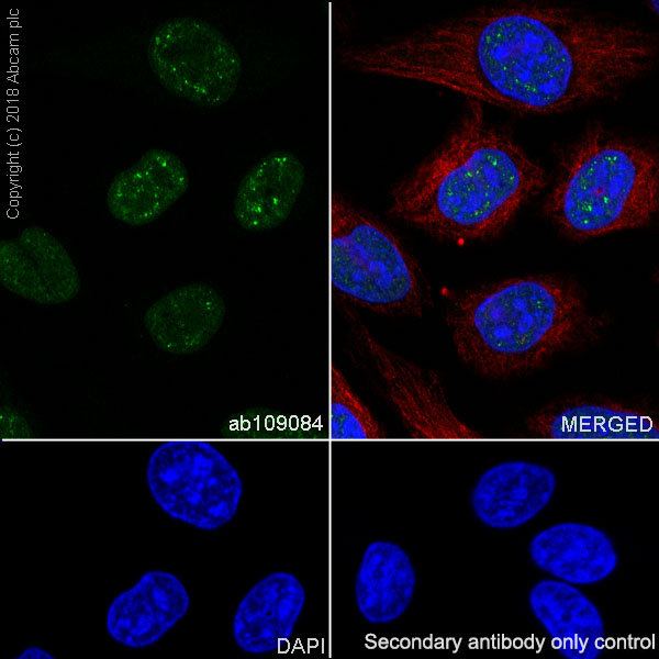 Immunocytochemistry/ Immunofluorescence - Anti-RPA32/RPA2 antibody [EPR2876(2)] (AB109084), expandable thumbnail