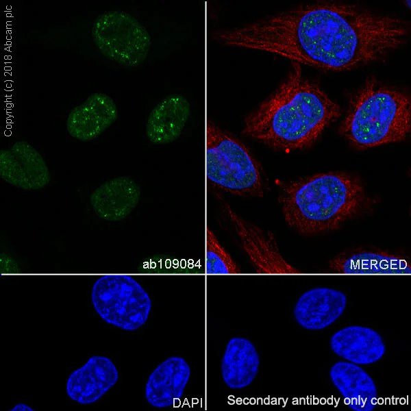 Immunocytochemistry/ Immunofluorescence - Anti-RPA32/RPA2 antibody [EPR2876(2)] (AB109084)