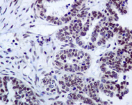 Immunohistochemistry (Formalin/PFA-fixed paraffin-embedded sections) - Anti-RPA32/RPA2 antibody [EPR2876(2)] (ab109084), expandable thumbnail