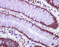 Immunohistochemistry (Formalin/PFA-fixed paraffin-embedded sections) - Anti-RPA32/RPA2 antibody [EPR2876(2)] (ab109084), expandable thumbnail
