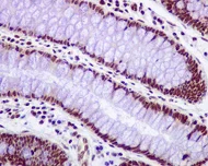 Immunohistochemistry (Formalin/PFA-fixed paraffin-embedded sections) - Anti-RPA32/RPA2 antibody [EPR2876(2)] (AB109084)