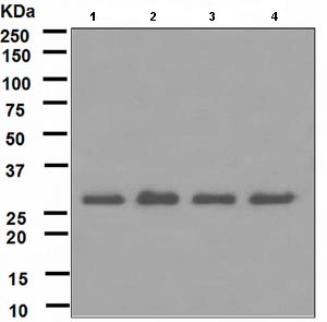 Western blot - Anti-RPA32/RPA2 antibody [EPR2876(2)] (AB109084), expandable thumbnail