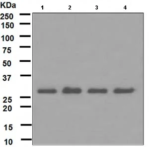 Western blot - Anti-RPA32/RPA2 antibody [EPR2876(2)] - BSA and Azide free (AB247754)