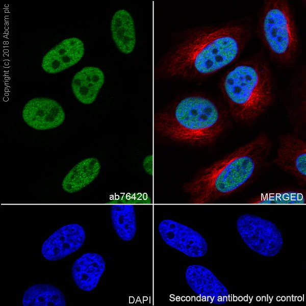 Immunocytochemistry/ Immunofluorescence - Anti-RPA32/RPA2 antibody [EPR2877Y] (AB76420)