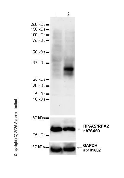 Western blot - Anti-RPA32/RPA2 antibody [EPR2877Y] (AB76420)