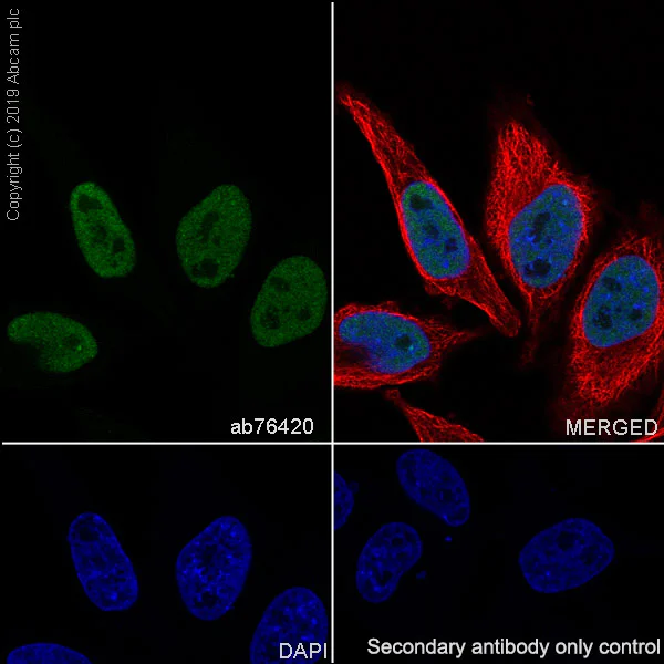 Immunocytochemistry/ Immunofluorescence - Anti-RPA32/RPA2 antibody [EPR2877Y] - BSA and Azide free (AB236044)