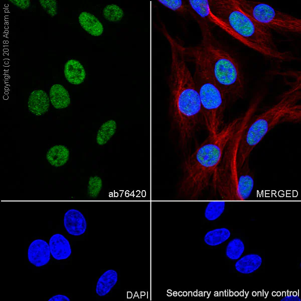 Immunocytochemistry/ Immunofluorescence - Anti-RPA32/RPA2 antibody [EPR2877Y] - BSA and Azide free (AB236044)