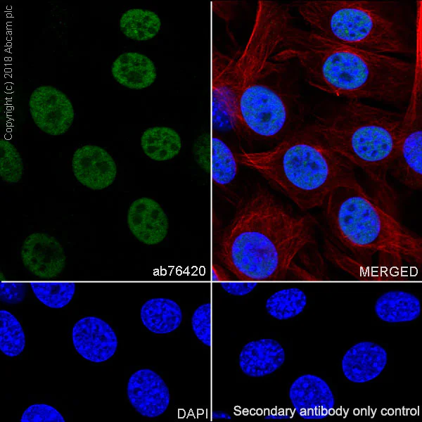 Immunocytochemistry/ Immunofluorescence - Anti-RPA32/RPA2 antibody [EPR2877Y] - BSA and Azide free (AB236044)