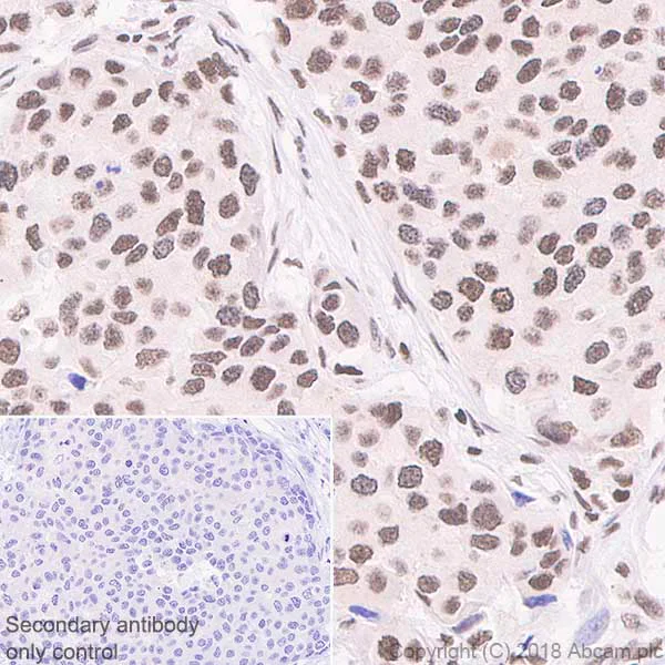 Immunohistochemistry (Formalin/PFA-fixed paraffin-embedded sections) - Anti-RPA32/RPA2 antibody [EPR2877Y] - BSA and Azide free (AB236044)