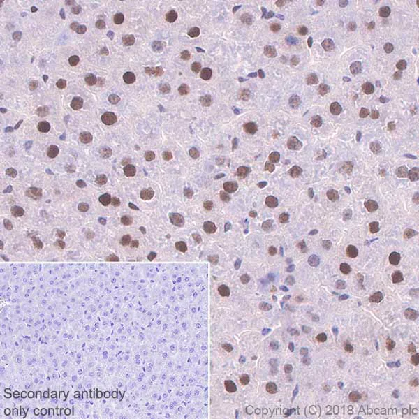 Immunohistochemistry (Formalin/PFA-fixed paraffin-embedded sections) - Anti-RPA32/RPA2 antibody [EPR2877Y] - BSA and Azide free (AB236044)